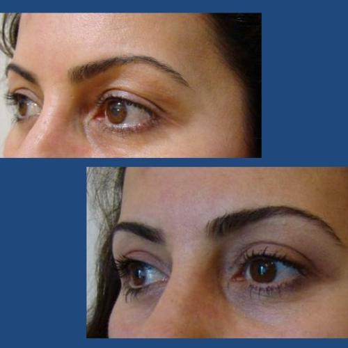 Before after photos of our patients 10